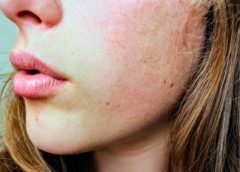 How to Have Fair and Glowing Face without Facial Cream